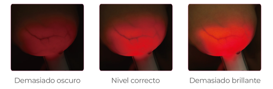 Luminous Breast Pro Series Device - Because Early Detection Saves Lives