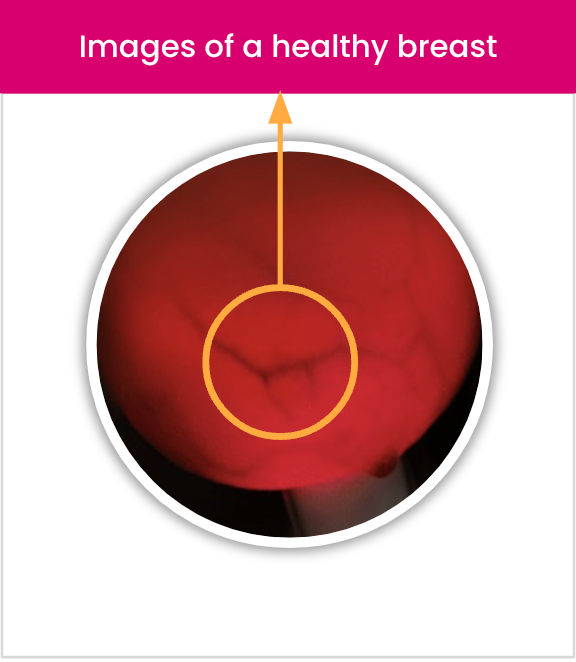 Luminous Breast Pro Series Device - Because Early Detection Saves Lives